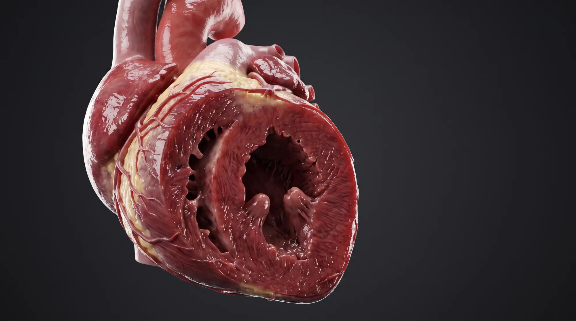 Heart cross-section — ventricular cavity with trabeculae carneae and papillary muscles